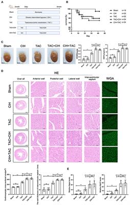 Chronic intermittent hypoxia accelerates cardiac dysfunction and cardiac remodeling during cardiac pressure overload in mice and can be alleviated by PHD3 overexpression